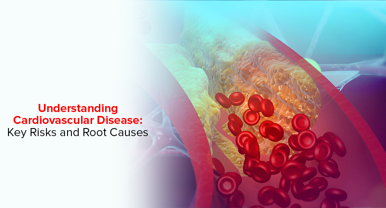 Understanding Cardiovascular Disease: Key Risks And Root Causes